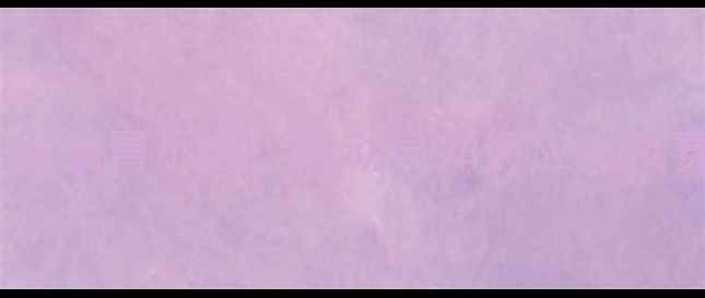 图片 足球比赛中突发肠胃不适：运动员如何应对及赛事应急措施2